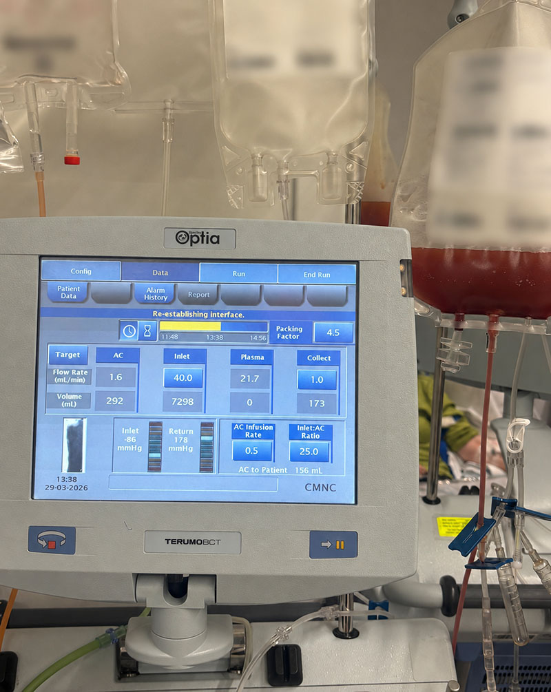 Car-t-therapy-for-lupus-2026.jpg
