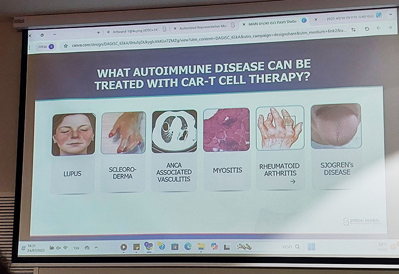 car-t-therapy-autoimmune-diseases-israel_0.jpg