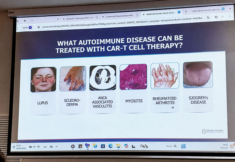 car-t-therapy-autoimmune-diseases-israel_2026-jpg.jpg