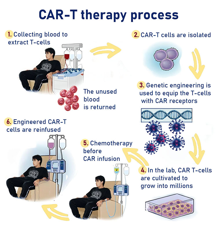 israel-car-t-cell-therapy-best-country-in-the-world-cost.jpg